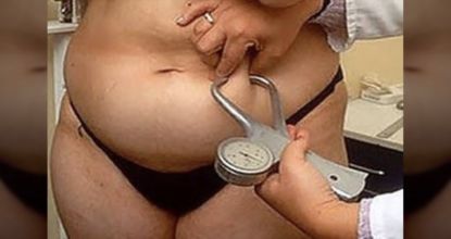 calipers measuring BMI on a woman's belly fat